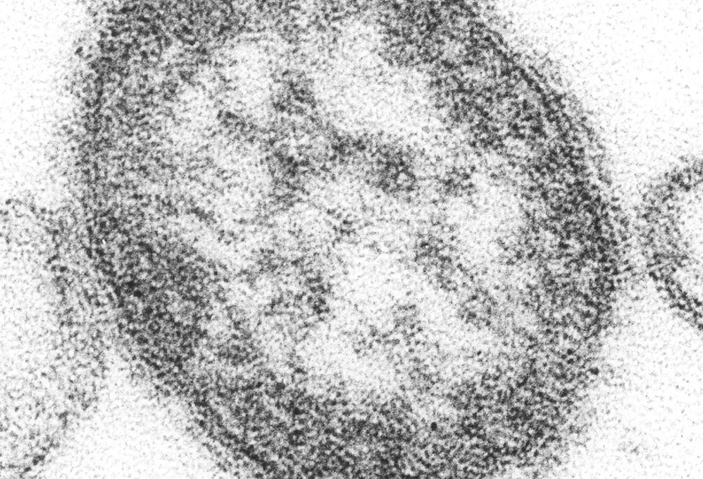 Sieht seiner Existenz gelassen entgegen: Masernvirus. Quelle: Cynthia Goldsmith/CDC, gemeinfrei